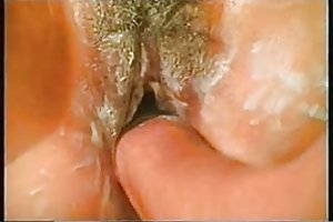 Anal fisting sexo seguro